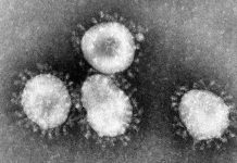 内陸部公衆衛生局からBC州内陸部ケローナでクラスター発生の注意喚起 Coronaviruses