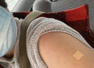 トルドー首相、ワクチン接種次第では規制緩和が早まる可能性に言及 ワクチン接種後。局部が腫れるということはなかったという。Photo © The Vancouver Shinpo