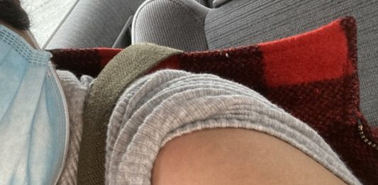 第二波まっただ中でのコロナワクチン接種 ~体験者に聞く~ ワクチン接種後。局部が腫れるということはなかったという。Photo © The Vancouver Shinpo